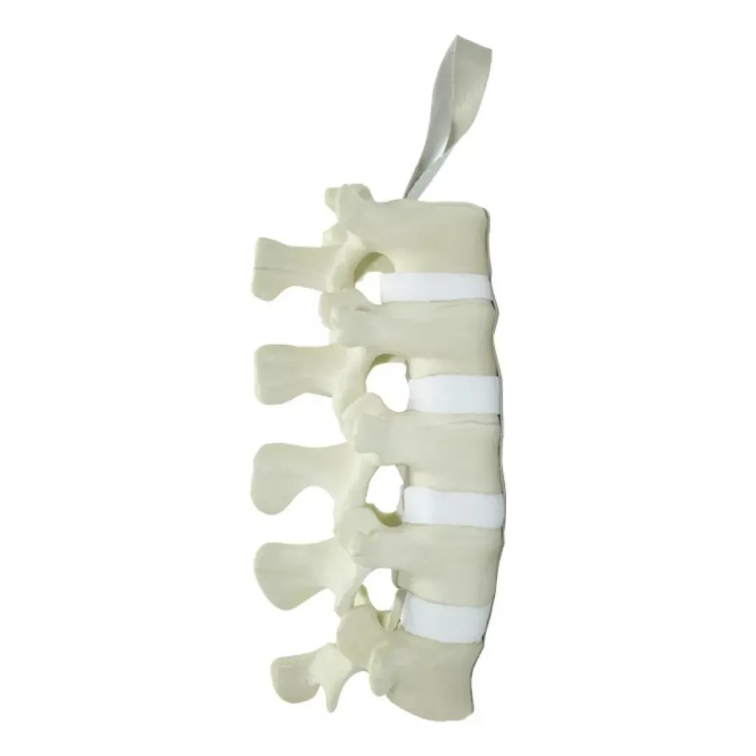 Columna Lumbar Ortopedia Educativa